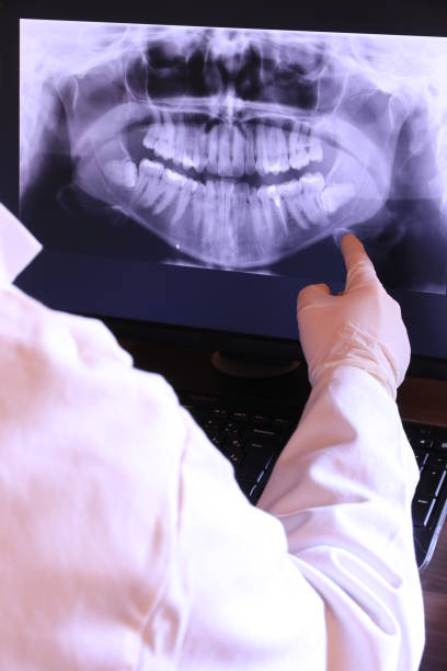 Best Emergency Root Canal Treatment in Fairfield Bay, AR